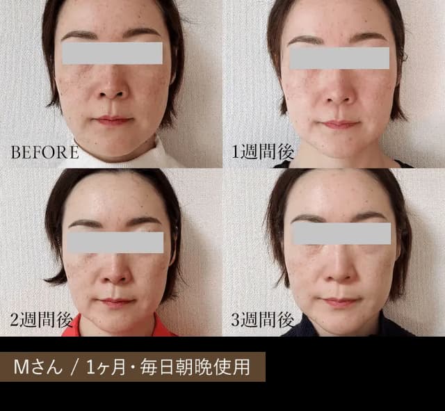 かんさいぼうこすめ ビフォーアフター1