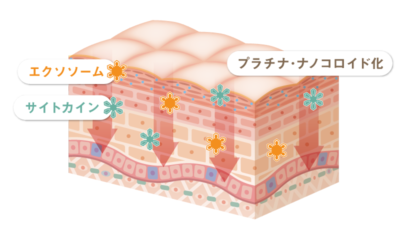 プラチナ・ナノコロイド化